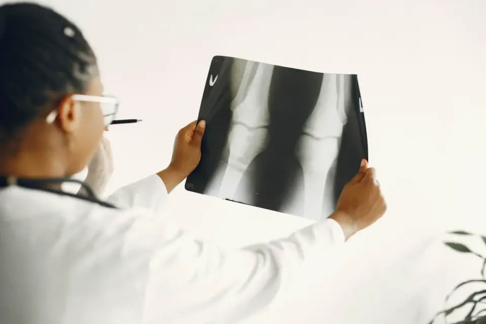 Illustration of a canine joint with reduced synovial fluid viscosity typical of osteoarthritis